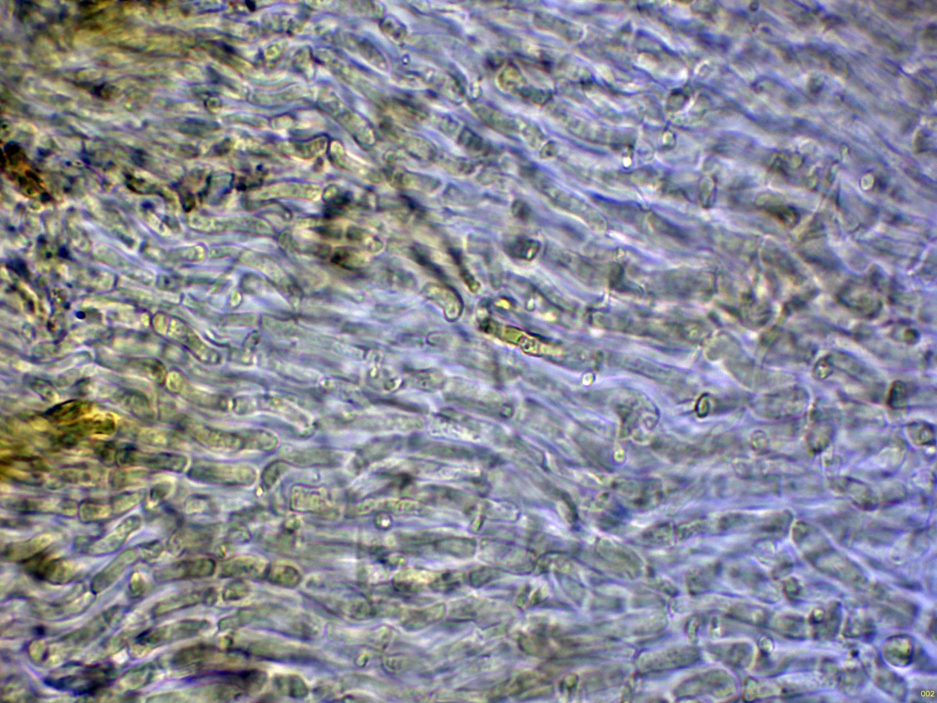 10 - Excípulo Melzer-002